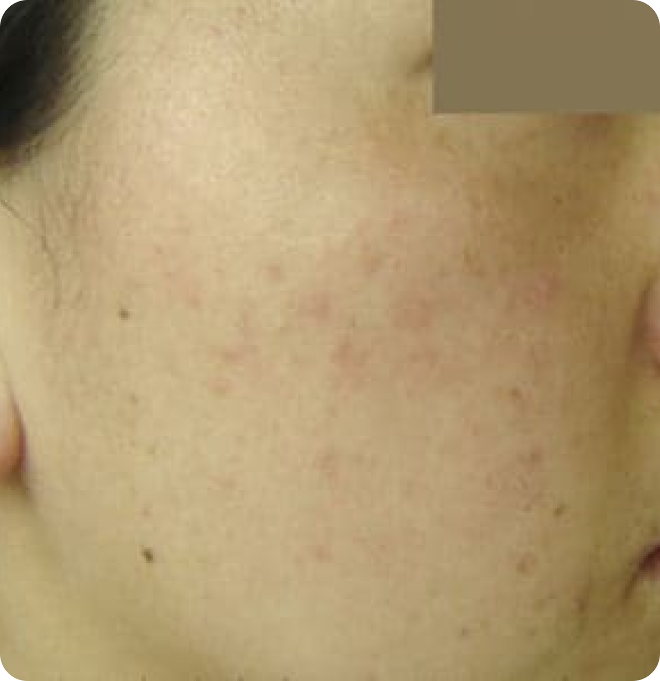 Advanced GSD IPL sPTF+ - Image 6